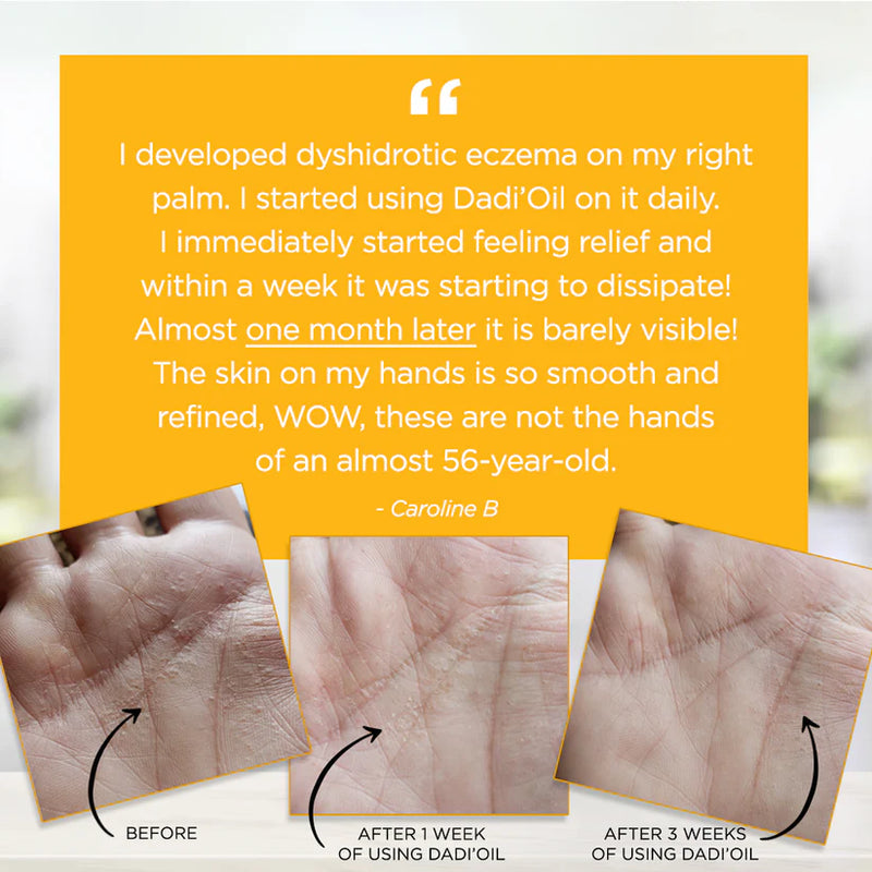 DADI' OIL CUTICLE OIL | UNIT - VARIOUS FORMATS - FAMOUS NAME