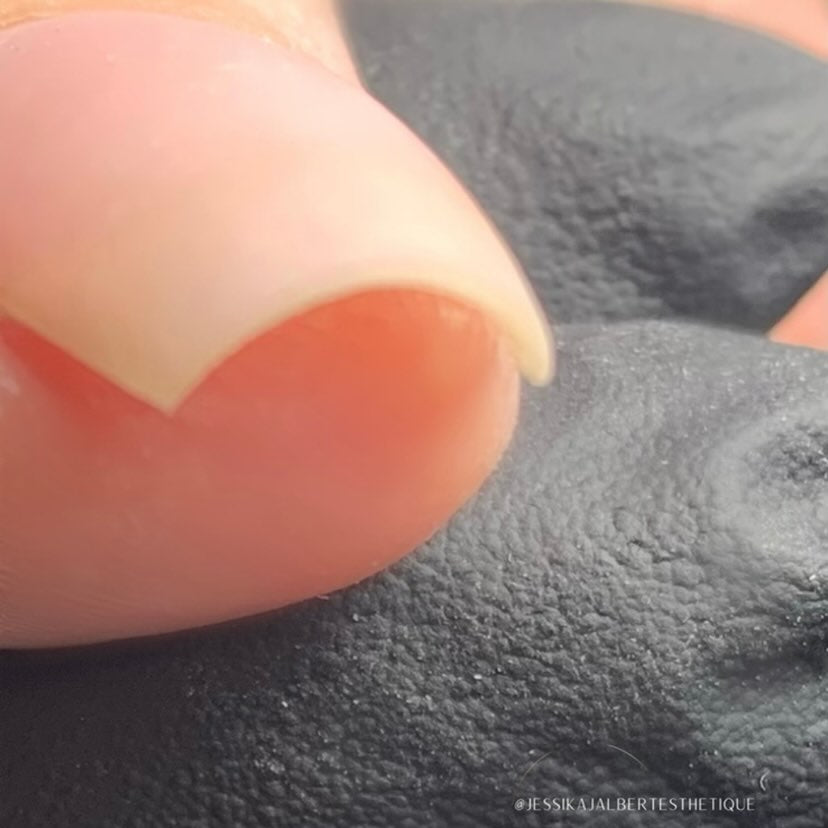 FORMATION INTRODUCTION ET PASSAGE AU GEL - JESSIKA JALBERT